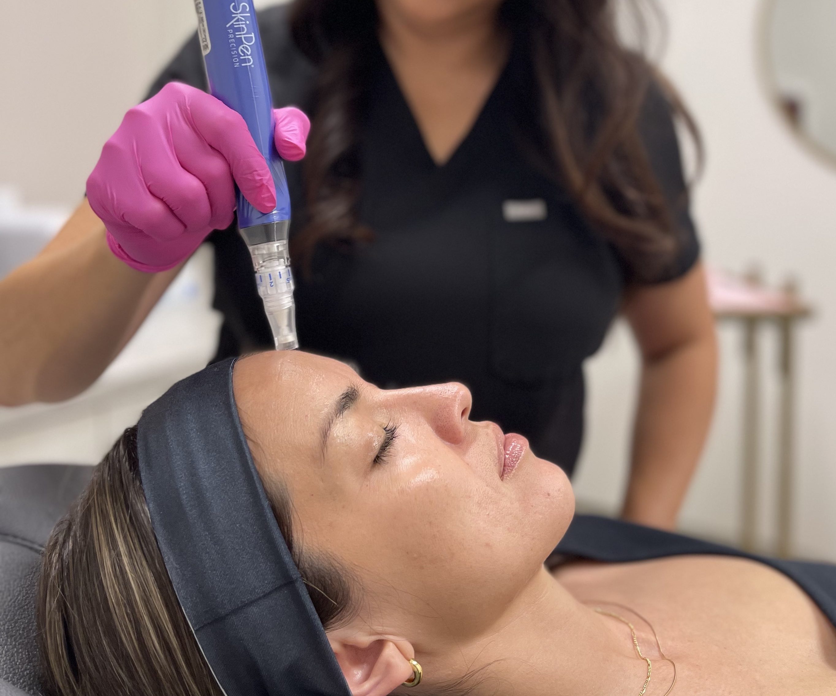 Model receiving microneedling treatment from Erica Bedsted at Refyned Aesthetics Medical Spa in Fresno